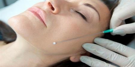 Facial Rejuvenation